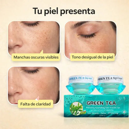 CREMA ELIMINACION MANCHAS FEIQUE