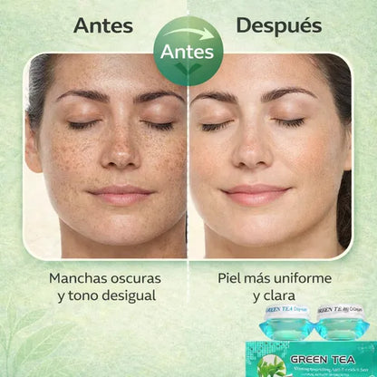 CREMA ELIMINACION MANCHAS FEIQUE