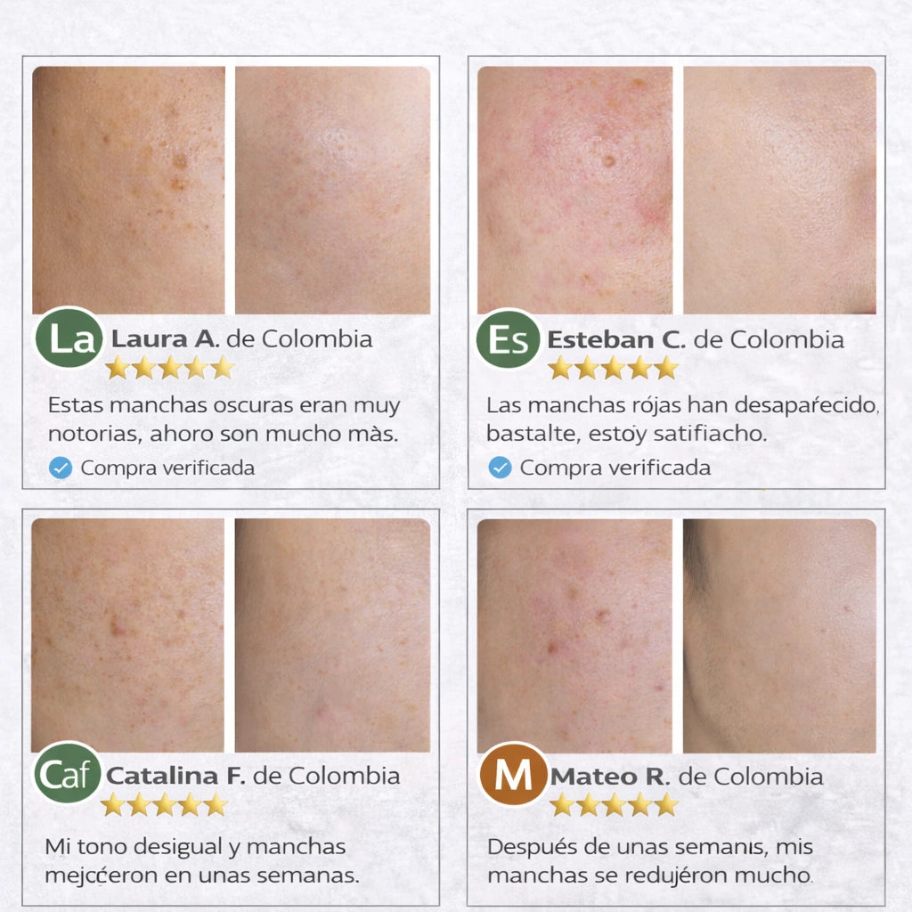 CREMA ELIMINACION MANCHAS FEIQUE