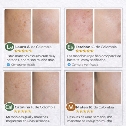 CREMA ELIMINACION MANCHAS FEIQUE