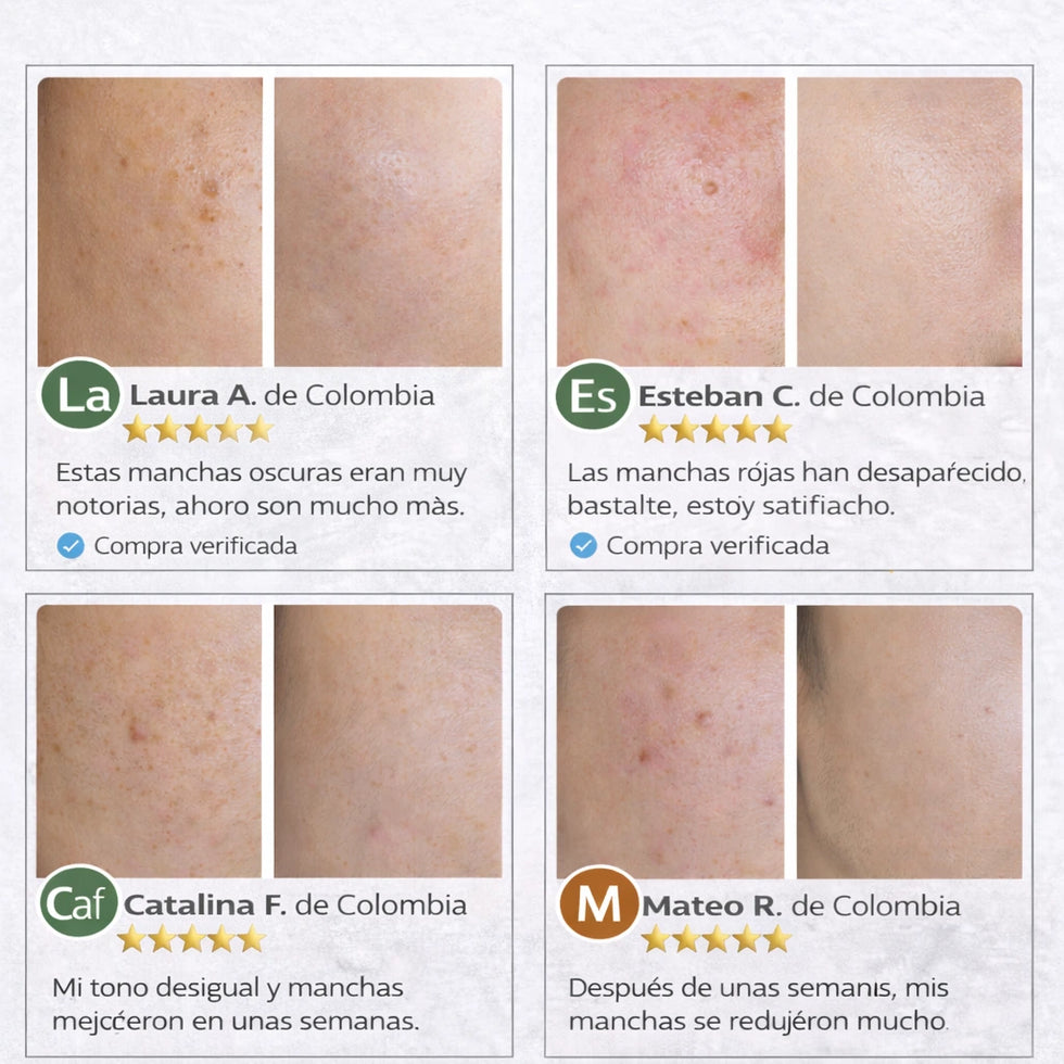 CREMA ELIMINACION MANCHAS FEIQUE comparación
