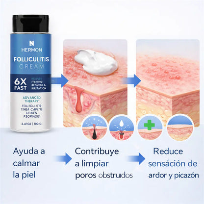 FOLLICULITIS CREAM