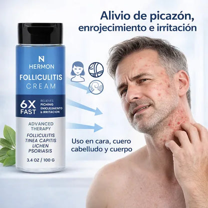 FOLLICULITIS CREAM