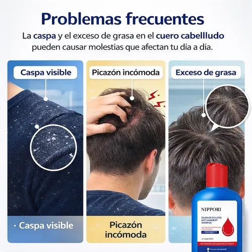 SHAMPOO NIPPORI ANTI CASPA