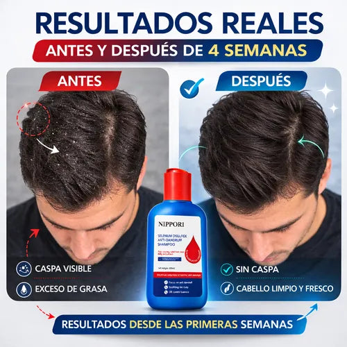 SHAMPOO NIPPORI ANTI CASPA antes y después